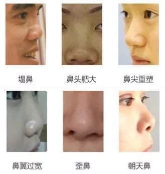 https://img.miyanlife.com/mnt/timg/171109/111U2Gc-13.jpg