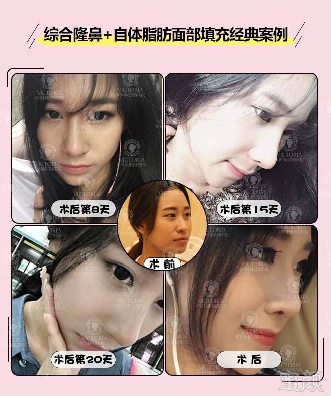 https://img.miyanlife.com/mnt/timg/171109/111U351b-15.jpg