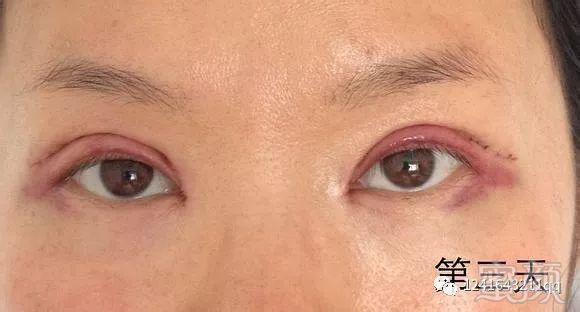 https://img.miyanlife.com/mnt/timg/171109/1131361S1-6.jpg