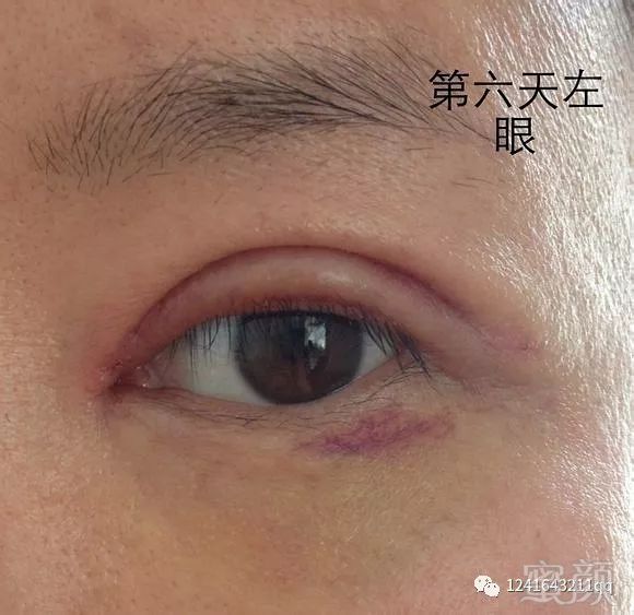 https://img.miyanlife.com/mnt/timg/171109/11313I544-10.jpg