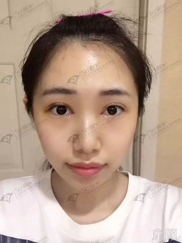 https://img.miyanlife.com/mnt/timg/171109/1134104O0-6.jpg
