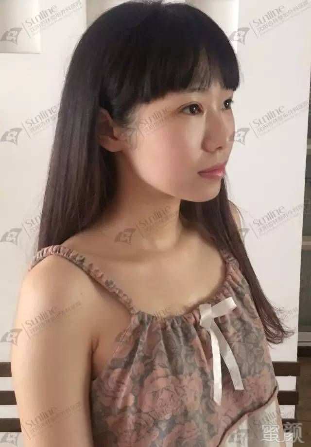 https://img.miyanlife.com/mnt/timg/171109/113410F44-7.jpg