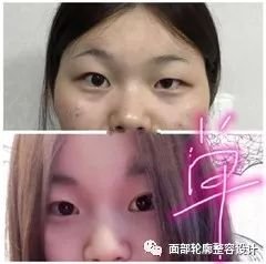 https://img.miyanlife.com/mnt/timg/171109/114109AX-0.jpg
