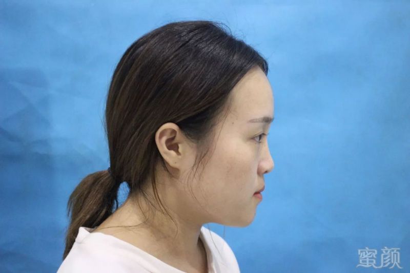 https://img.miyanlife.com/mnt/timg/171109/1142455C6-5.jpg