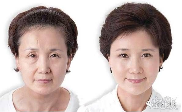 https://img.miyanlife.com/mnt/timg/171110/093A06438-0.jpg