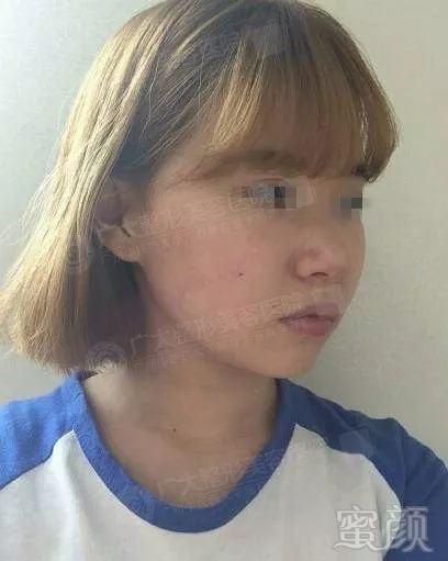 https://img.miyanlife.com/mnt/timg/171110/094P21203-5.jpg