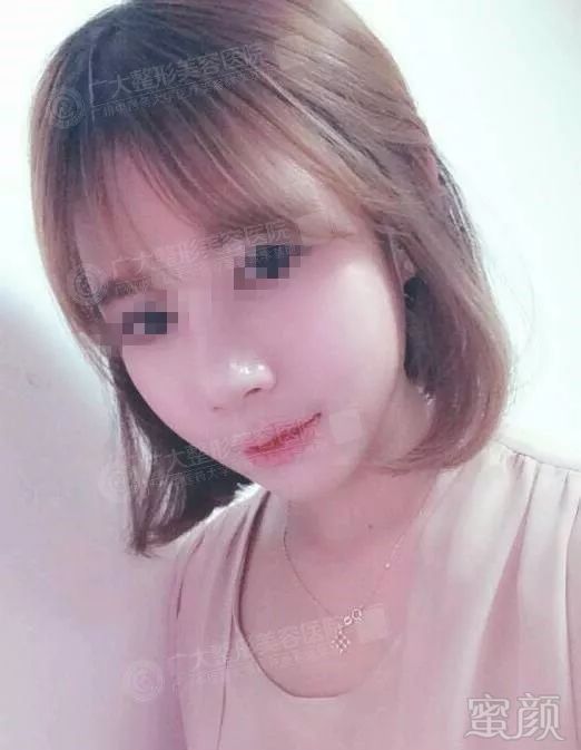 https://img.miyanlife.com/mnt/timg/171110/094P45549-10.jpg
