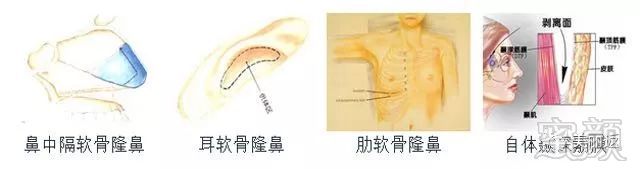 https://img.miyanlife.com/mnt/timg/171110/0955342b1-8.jpg