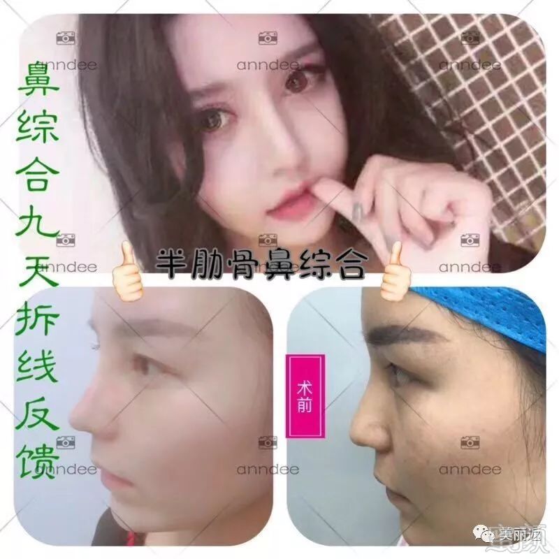 https://img.miyanlife.com/mnt/timg/171110/095534Ic-10.jpg
