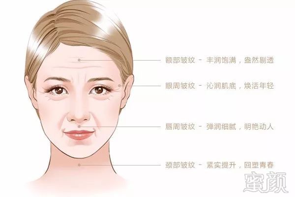 https://img.miyanlife.com/mnt/timg/171110/10031C2R-10.jpg