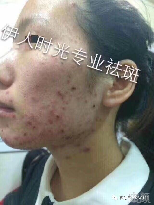 案例图片