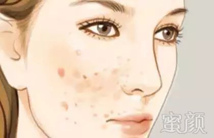 https://img.miyanlife.com/mnt/timg/171110/132PJ429-1.jpg