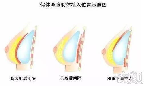 https://img.miyanlife.com/mnt/timg/171110/140I0F44-8.jpg