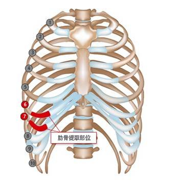 案例图片