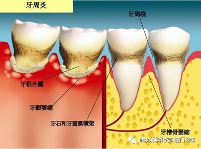 https://img.miyanlife.com/mnt/timg/171111/105F62145-7.jpg