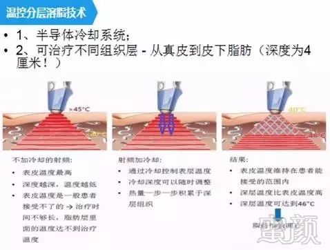 案例图片