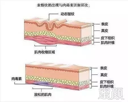 案例图片