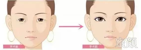 https://img.miyanlife.com/mnt/timg/171111/112QR333-1.jpg
