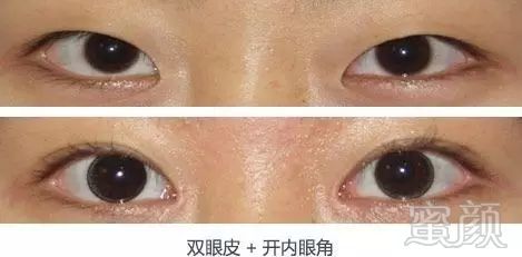 https://img.miyanlife.com/mnt/timg/171111/112R01223-9.jpg