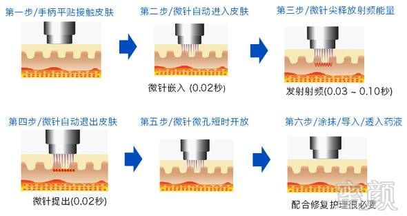 案例图片