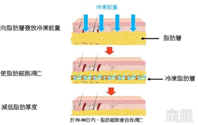 案例图片