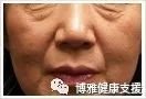 案例图片