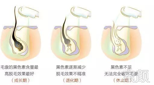 案例图片