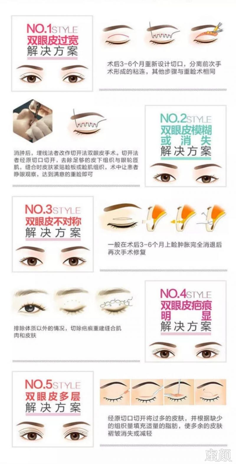 https://img.miyanlife.com/mnt/timg/171112/12503530M-10.jpg