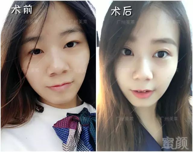 https://img.miyanlife.com/mnt/timg/171112/1259116112-14.jpg