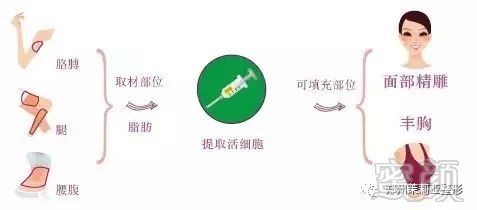 https://img.miyanlife.com/mnt/timg/171113/112U96406-4.jpg
