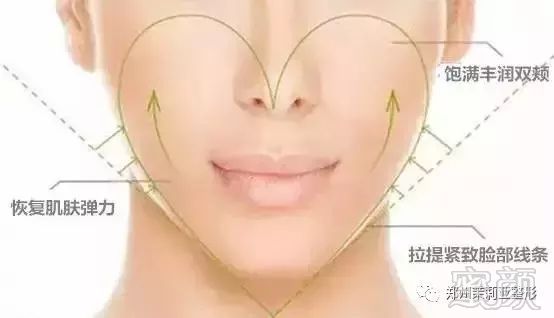 https://img.miyanlife.com/mnt/timg/171113/112Z04648-7.jpg