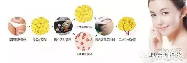https://img.miyanlife.com/mnt/timg/171113/112Z12107-9.jpg