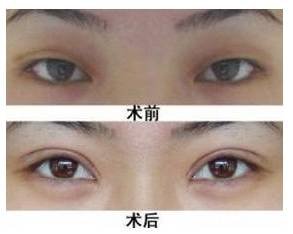 https://img.miyanlife.com/mnt/timg/171113/1140534149-4.jpg