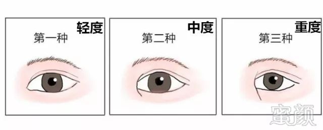 https://img.miyanlife.com/mnt/timg/171114/132R92522-3.jpg