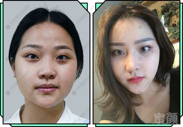 https://img.miyanlife.com/mnt/timg/171114/132R94247-1.jpg