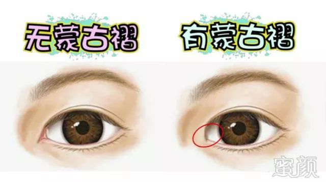 https://img.miyanlife.com/mnt/timg/171114/132R950N-2.jpg