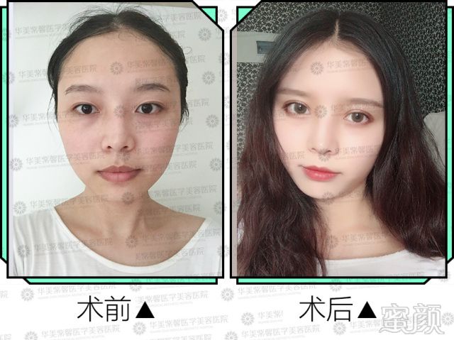 https://img.miyanlife.com/mnt/timg/171114/132RW223-0.jpg