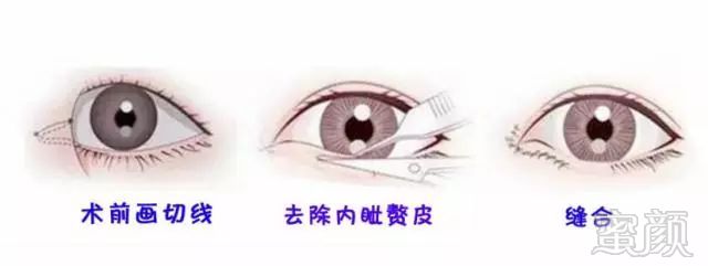 https://img.miyanlife.com/mnt/timg/171114/132S06309-7.jpg