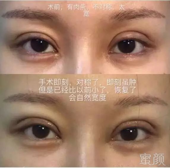 https://img.miyanlife.com/mnt/timg/171114/1345115945-8.jpg