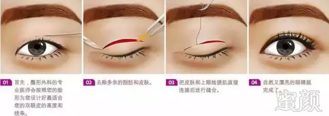 https://img.miyanlife.com/mnt/timg/171114/13463Hc8-3.jpg