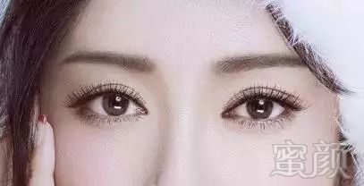 https://img.miyanlife.com/mnt/timg/171114/13463JP3-2.jpg