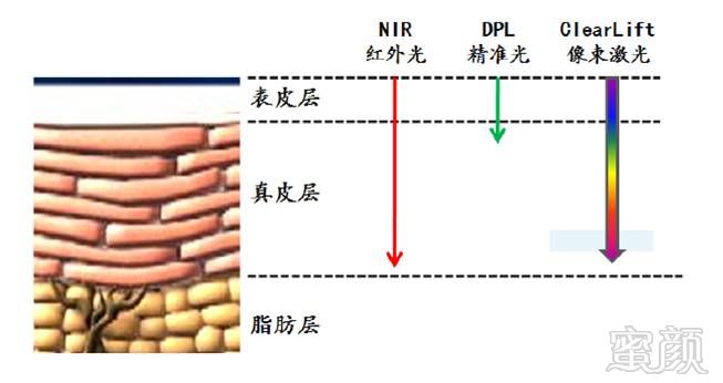 https://img.miyanlife.com/mnt/timg/171115/130JG942-1.jpg