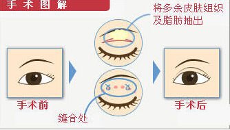 案例图片