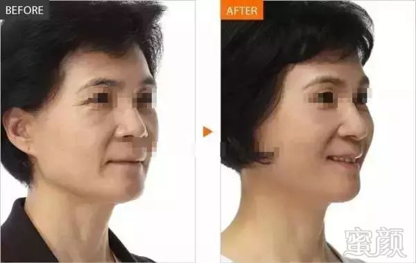 https://img.miyanlife.com/mnt/timg/171116/1152311C3-6.jpg