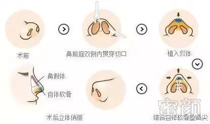 https://img.miyanlife.com/mnt/timg/171116/1213415A0-3.jpg