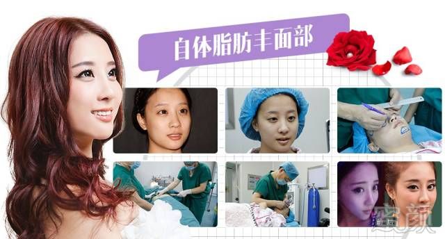 https://img.miyanlife.com/mnt/timg/171117/10395A607-1.jpg