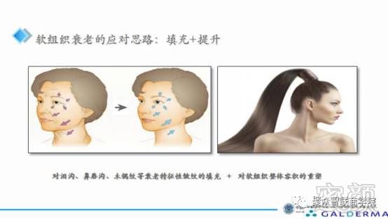 https://img.miyanlife.com/mnt/timg/171117/124934C63-12.jpg