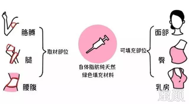 https://img.miyanlife.com/mnt/timg/171117/125Z21a7-1.jpg