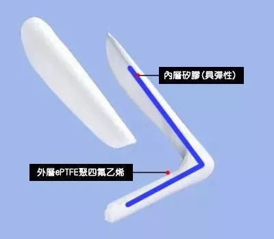 https://img.miyanlife.com/mnt/timg/171117/1324401622-2.jpg