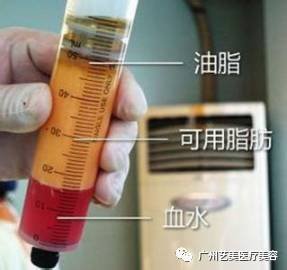 https://img.miyanlife.com/mnt/timg/171119/131U24020-3.jpg